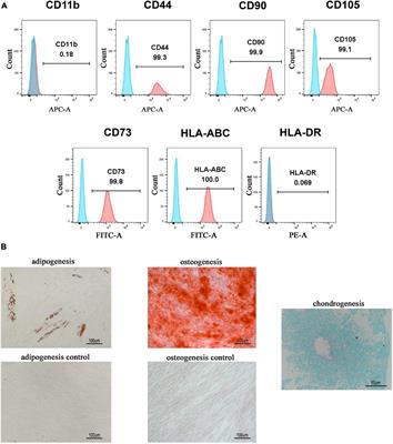 Frontiers Transplantation of Human Gingiva Derived Mesenchymal